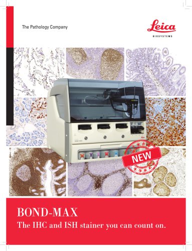 BOND-MAX Fully automated IHC and ISH