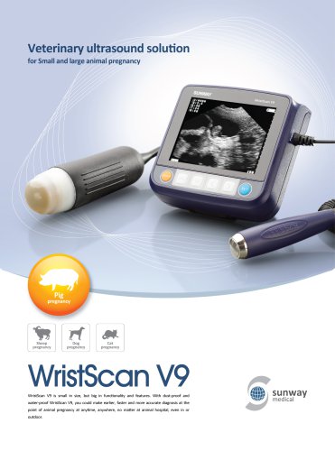 WristScan V9